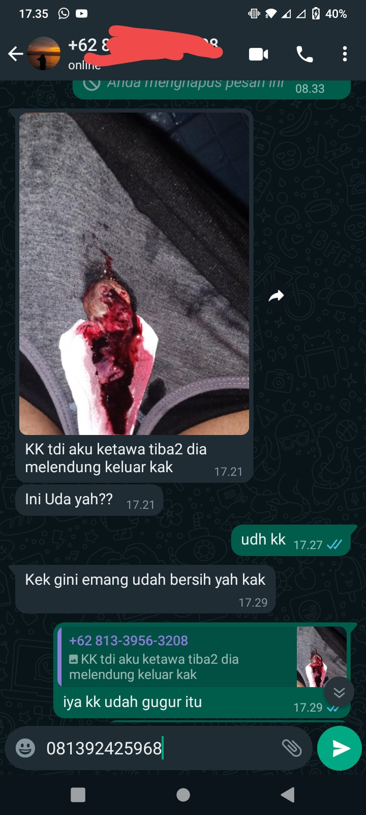 Jual Obat Aborsi JAKARTA PUSAT (Ampuh100%) 081392425968 Klinik Jual Obat Penggugur Kandungan  